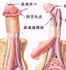 生殖整形案例2