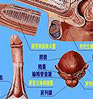 性功能障碍案例2
